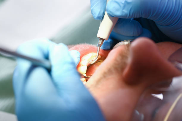 Best Walk-In Emergency Dentist in Todd Creek, CO